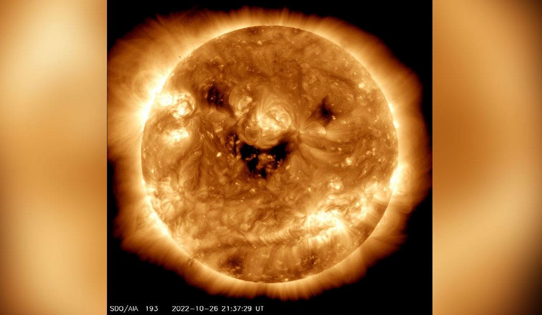 coronal